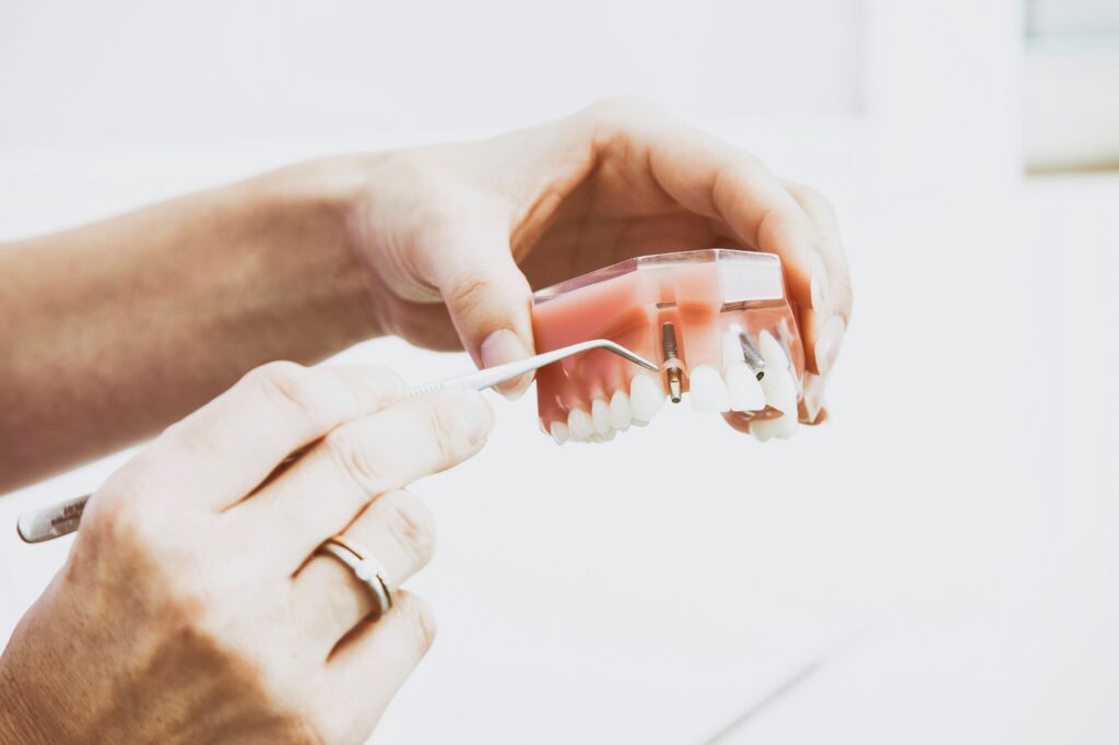 Zirconia Training